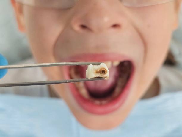 Best Holiday Emergency Dentist in Manchester, WA